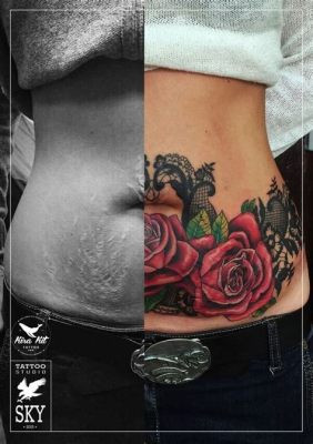 Can U Tattoo Over Stretch Marks: Exploring the Art of Skin Transformation